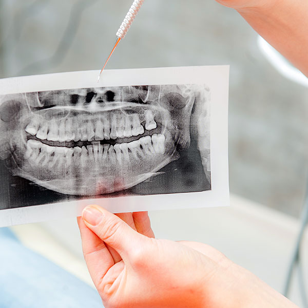 顯微根管治療<span>Micro Endodontics</span> 顯微根管治療<span>Micro Endodontics</span>